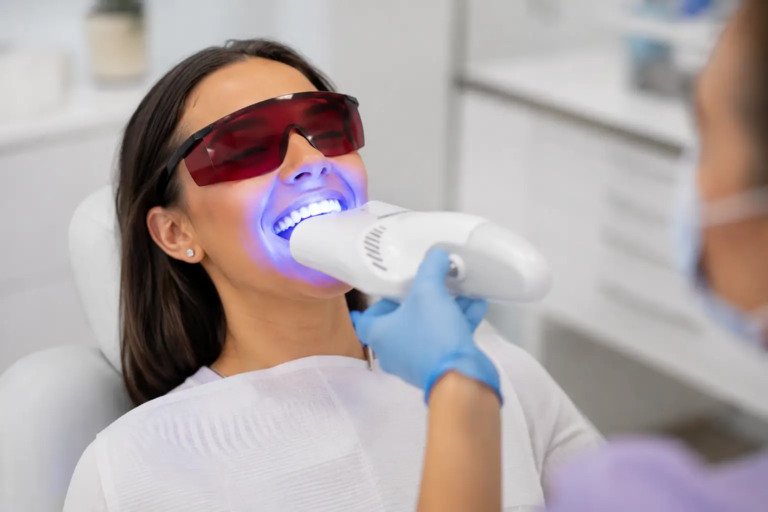 Bright Teeth Whitening Treatment